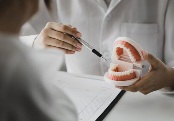 dental-implant-diş-kalitesi dental implant